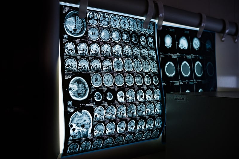 Body Scan